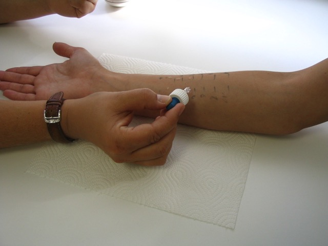 Allergiediagnostik
